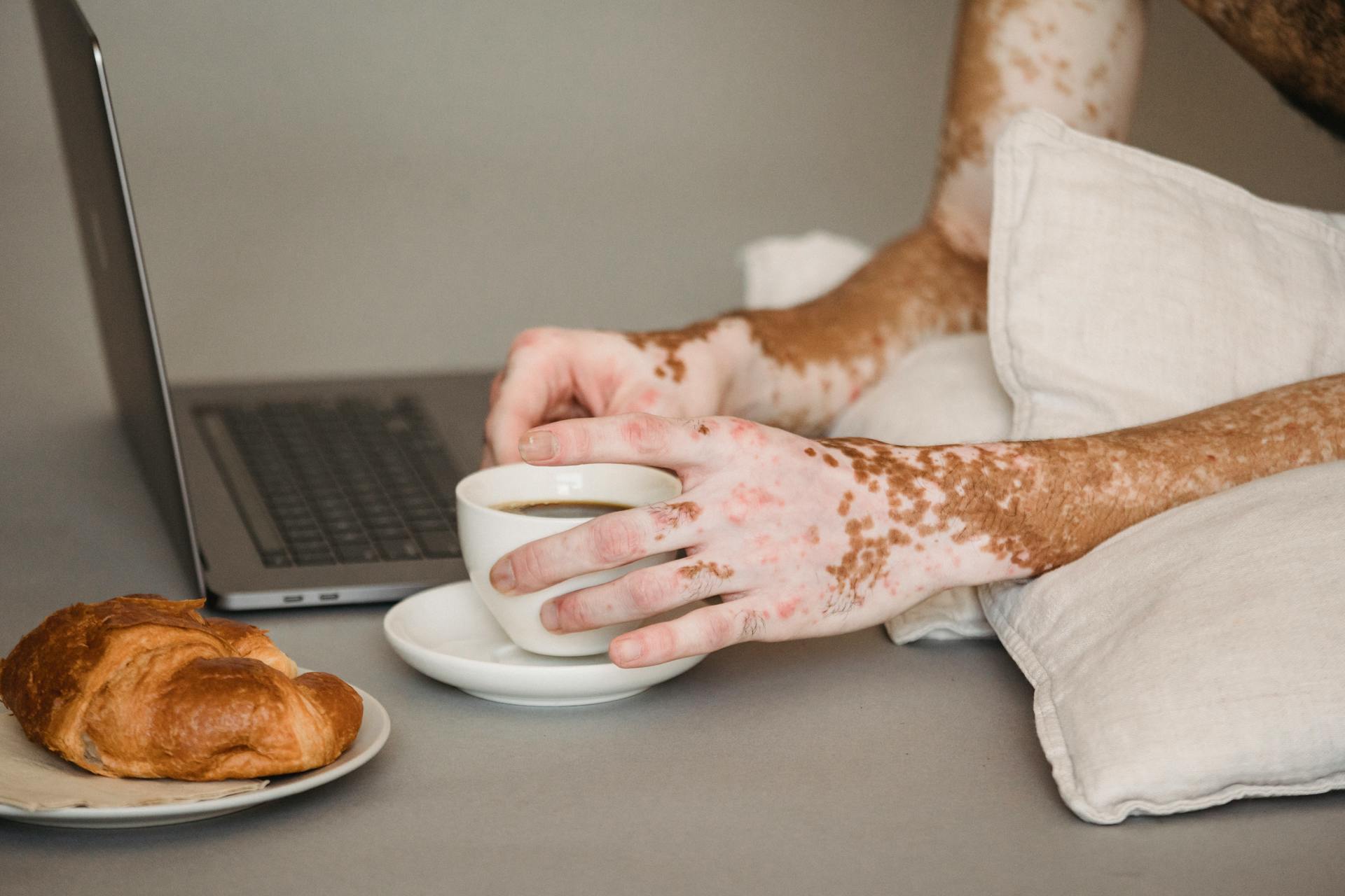 Crop anonymous male living with psoriasis resting on pillows on floor with modern netbook and enjoying freshly brewed black coffee