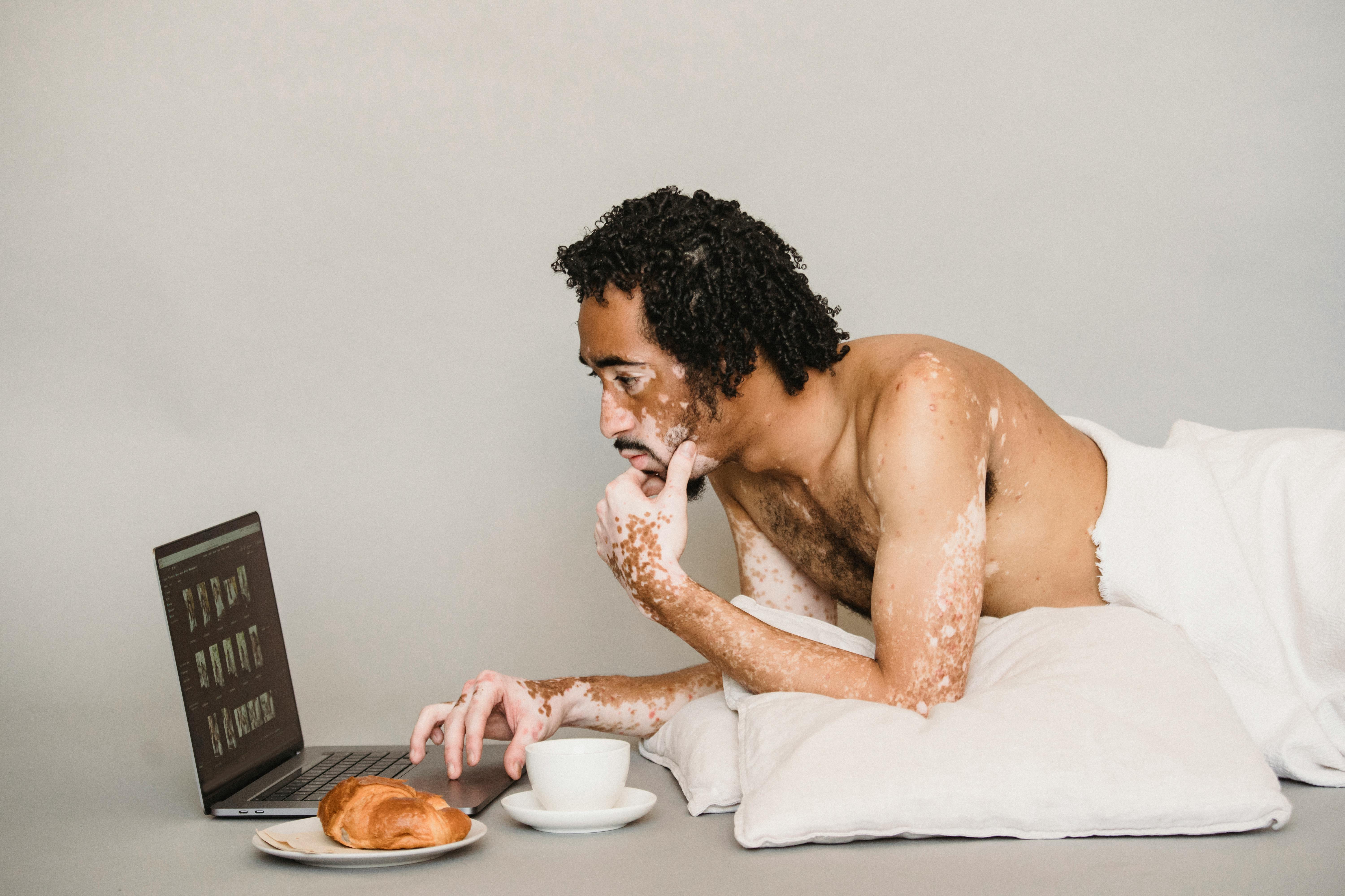 shirtless black man with vitiligo using laptop on floor