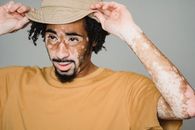 Young male in yellow T shirt with beard and vitiligo wearing hat and looking away on white background of studio