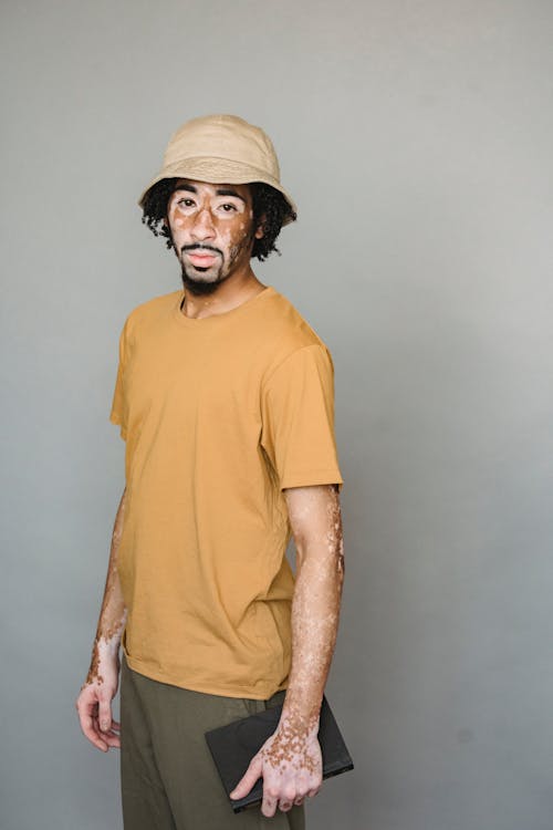 Free Calm male with vitiligo in trendy outfit standing with black notebook and looking at camera against gray background Stock Photo