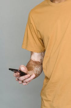 Close-up of a person with vitiligo using a smartphone, wearing a yellow t-shirt.