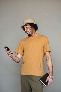 一名患有白癜风的年轻人随意站立在灰色工作室背景下，一手拿着笔记本电脑，一手使用着智能手机