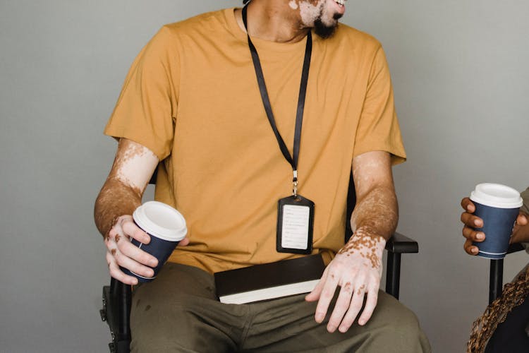 Crop Man With Vitiligo Skin Drinking Coffee