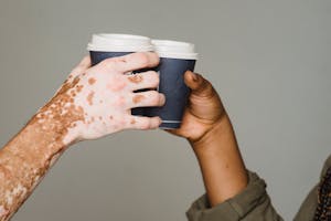 Unrecognizable man with vitiligo skin and anonymous African American male clinking with hot drinks on gray background during coffee break