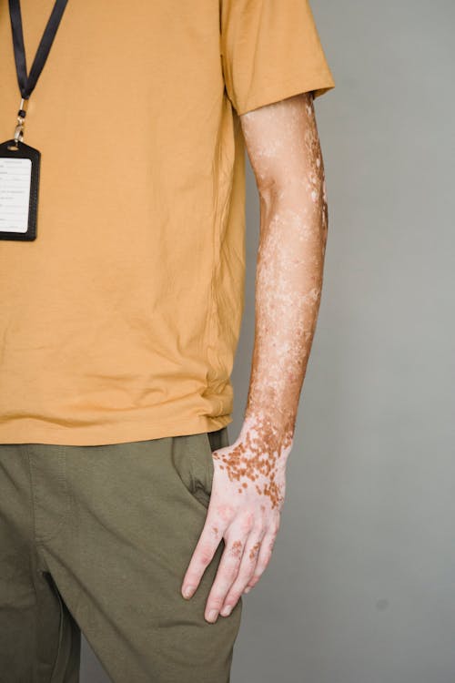 Gratis Pangkas Pria Dengan Vitiligo Di Studio Foto Stok