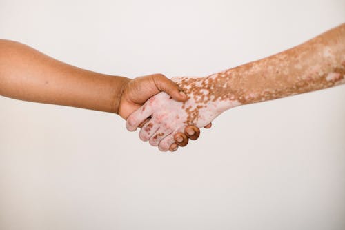 Free Crop anonymous man shaking hand of male friend with vitiligo skin against white background Stock Photo