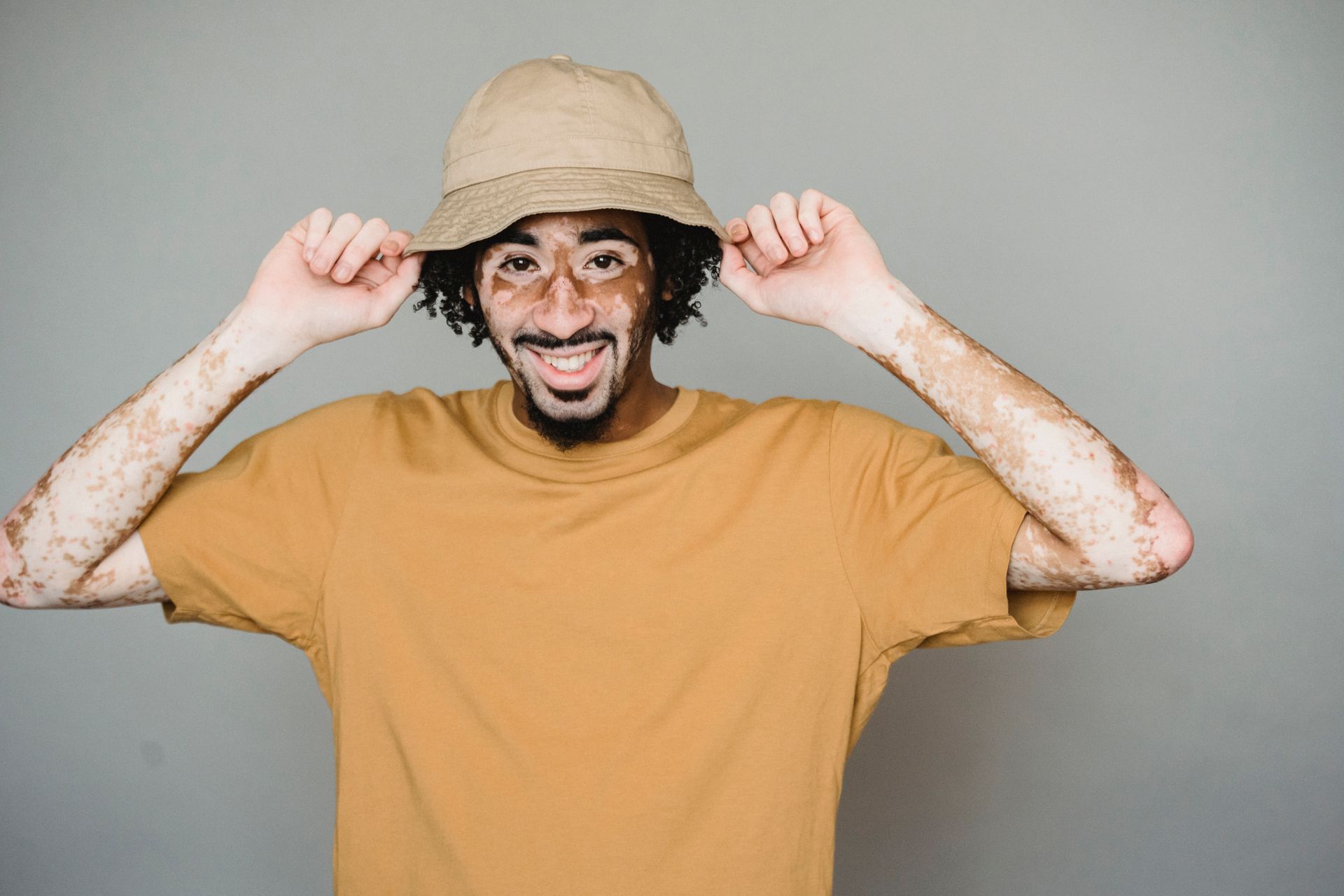 Content African American male living with psoriasis in casual shirt putting on summer hat and looking at camera with smile