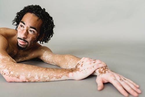 Спокойный черный мужчина без рубашки с кожей витилиго, лежащий на полу