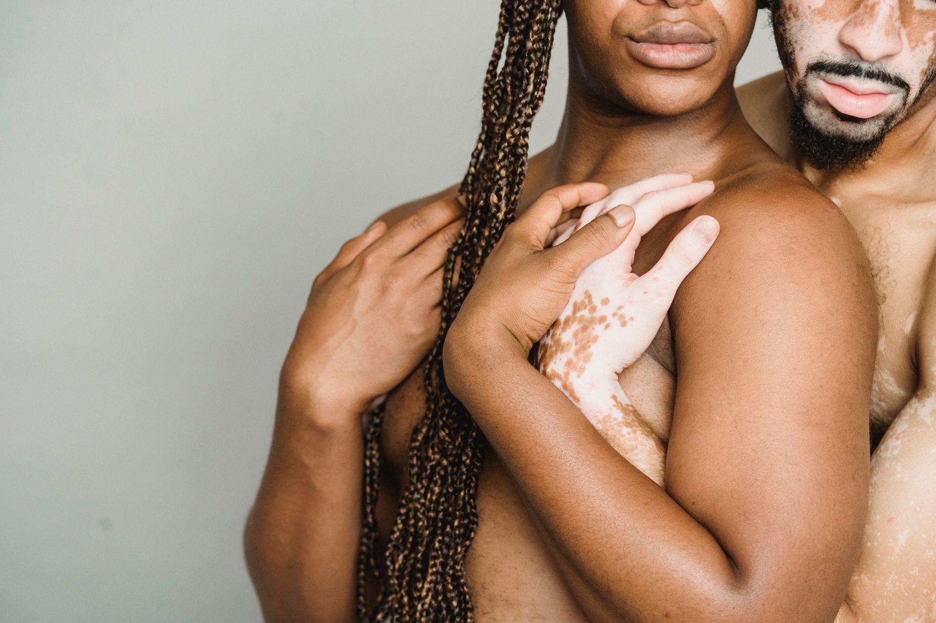 Psoriasis Progression: Understanding How This Skin Condition Evolves
