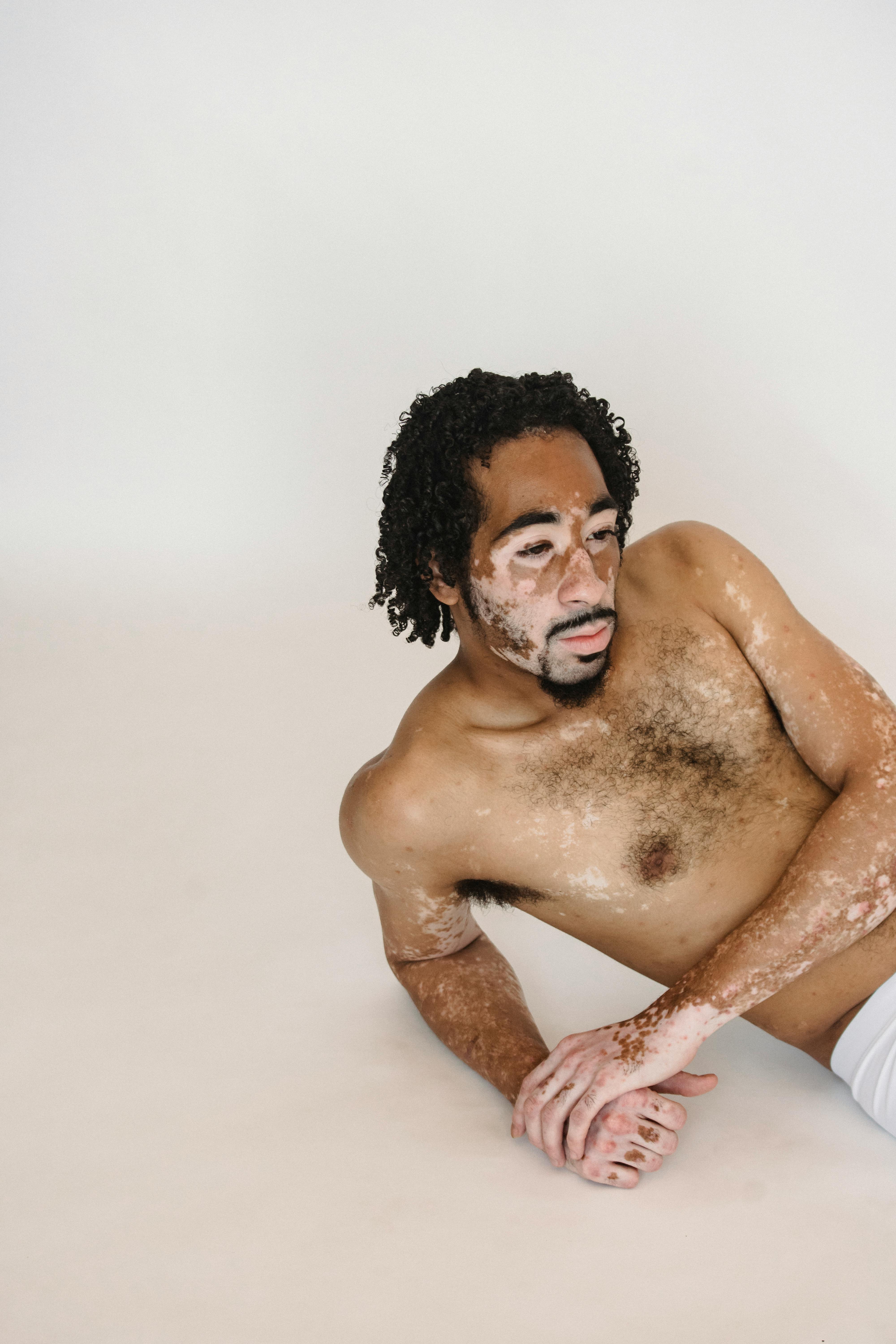 contemplative shirtless black man with vitiligo lying on floor