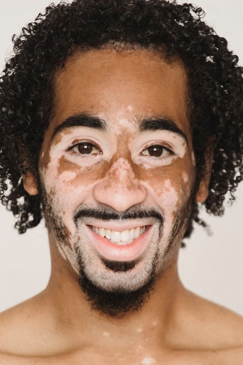 Crop shirtless black man with vitiligo skin · Free Stock Photo