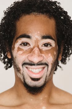 Close-up portrait of a cheerful man with vitiligo and curly hair on a white background.