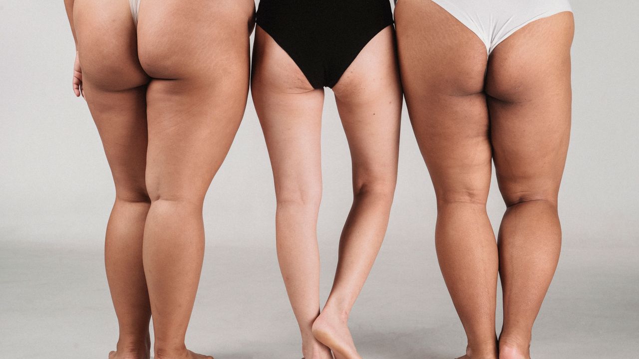 Lipo Corporal Enzimática: Guia Completo de Cuidados Pós-Procedimento em Jaú - Augusta Perfection