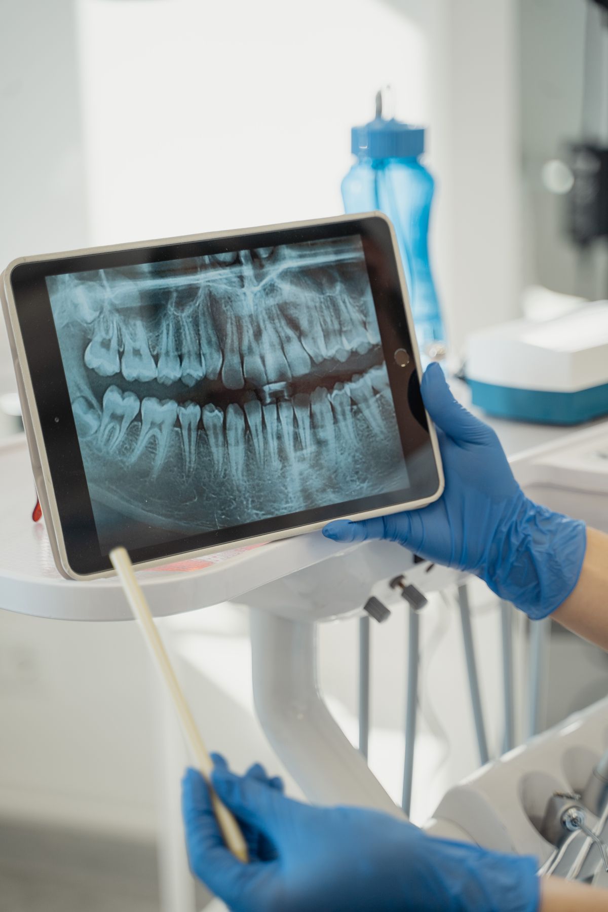 Odontólogo revisando una radiografía panorámica en una tableta