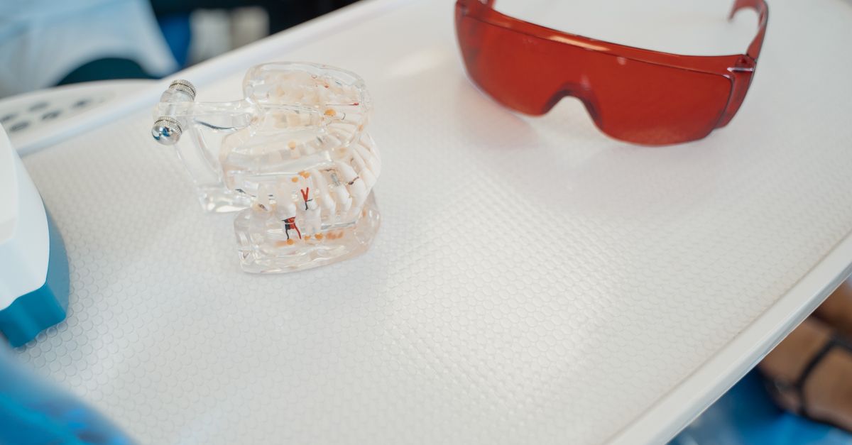 Close-up of a dental cast and red protective glasses on a white dental tray.