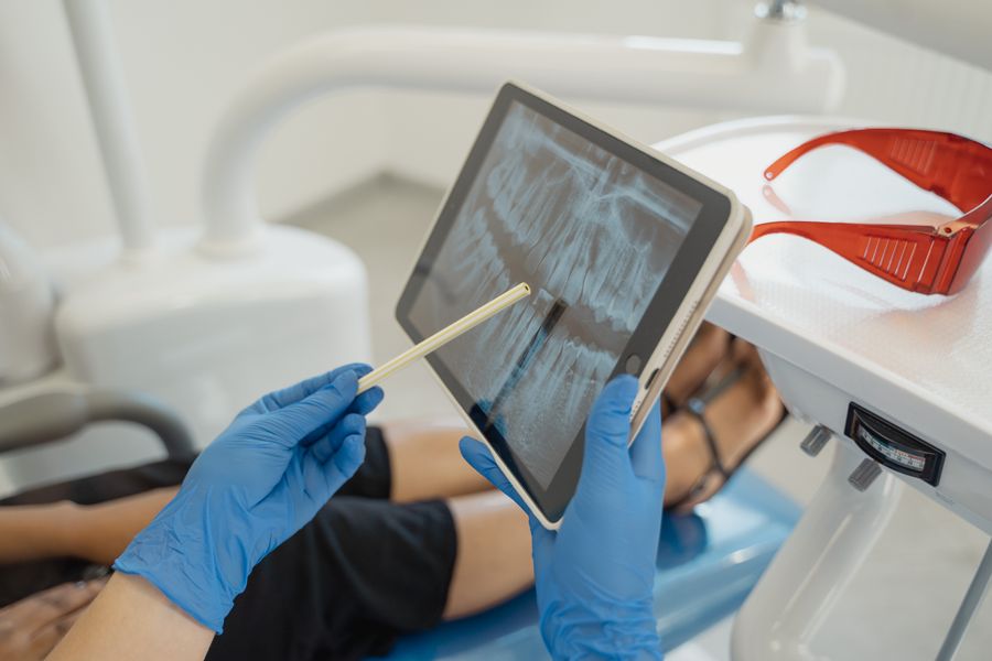 Dental x-ray diagnosis before surgical tooth care