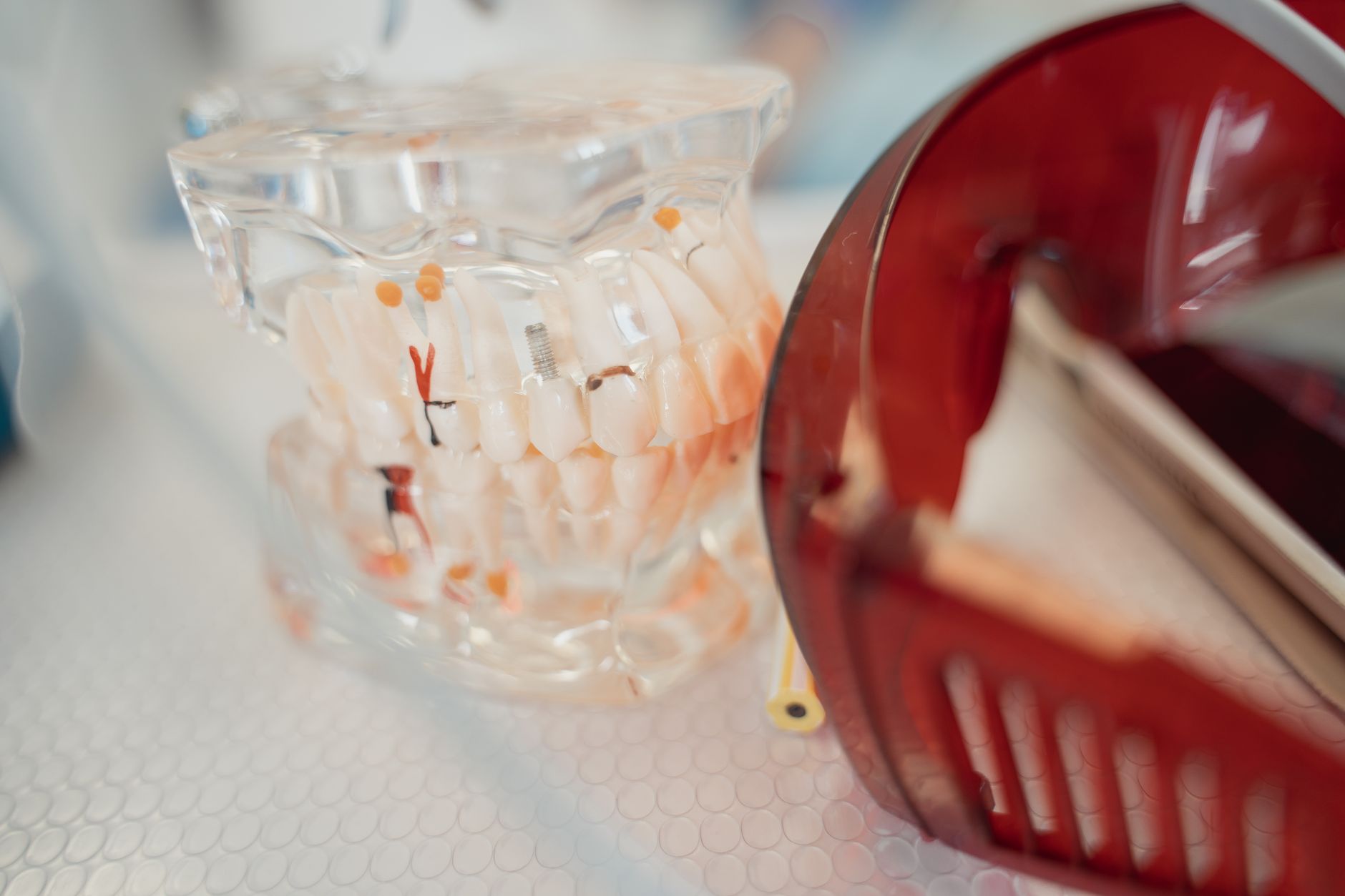 Dental Implants - Denwest Dental Clinic Dental Implants in Concord, Ontario - When is Wisdom Teeth Removal Necessary in Concord, Ontario?