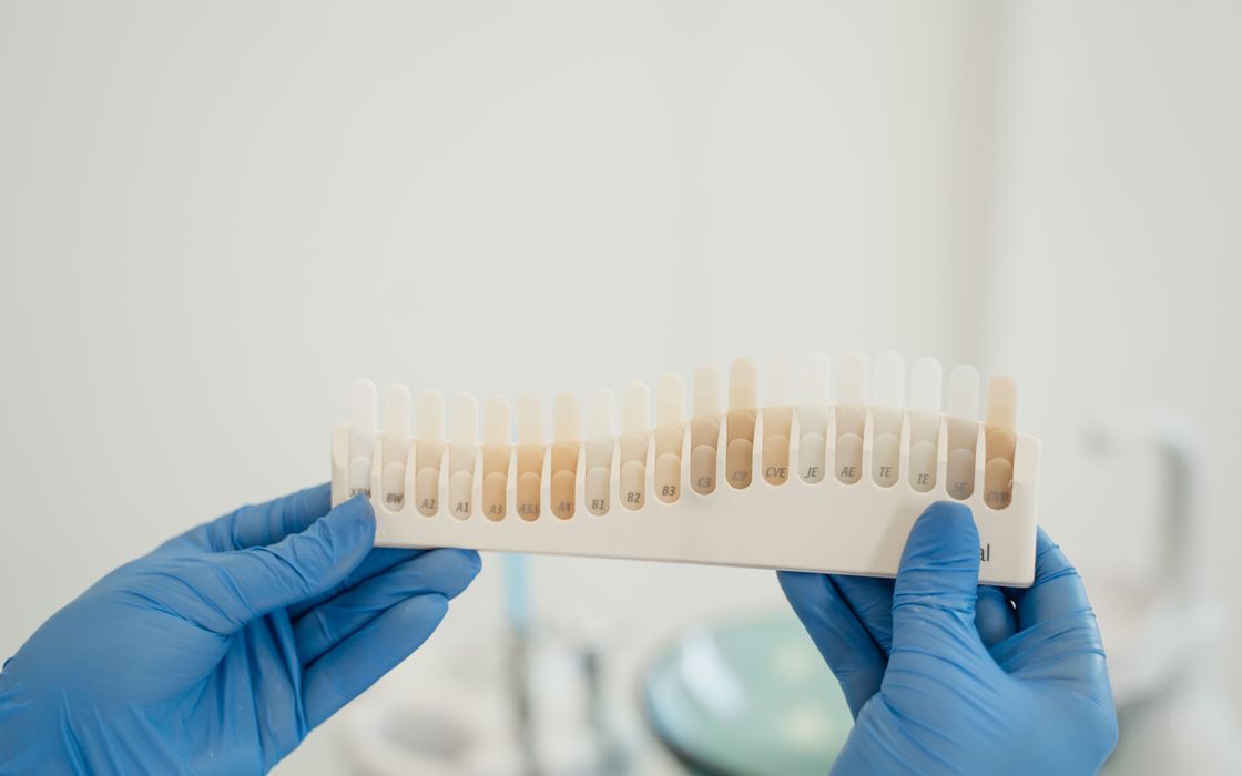 Gloved hands holding a tooth shade guide used to match tooth-coloured resin to natural teeth
