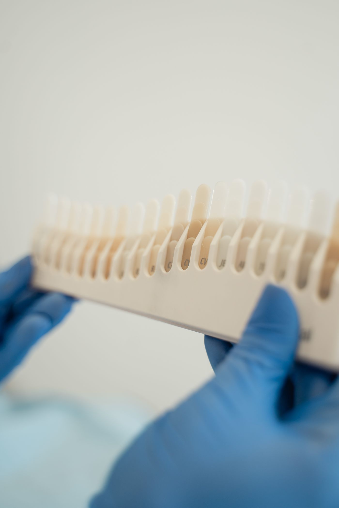 Close clinical assessment using a VITA dental shade guide