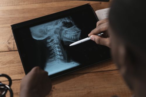 Free Doctor examining a spinal x-ray on a tablet using a stylus. Modern medical analysis. Stock Photo
