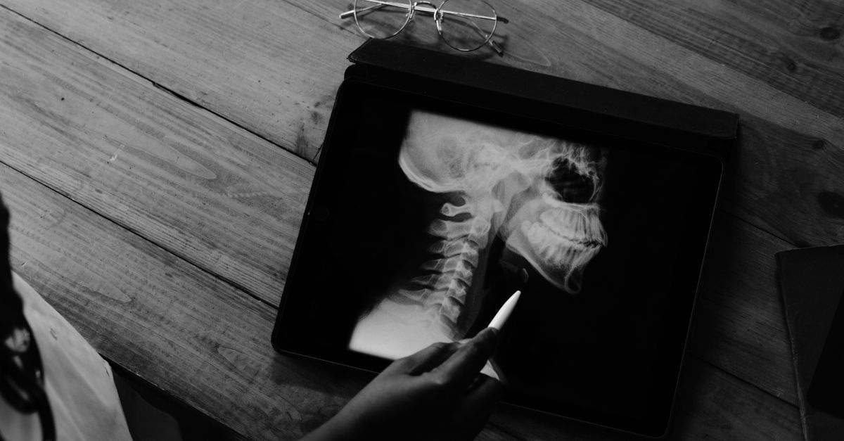 A doctor examining an X-ray image on a tablet in a medical setting, focusing on a patient's neck. - Evidence evidence guide for vitamin K2 fracture meta-analysis