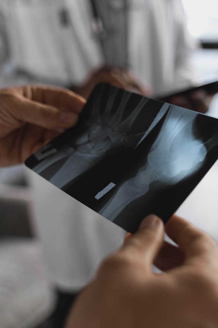 Close-up Photo Of An X-ray Held By A Doctor