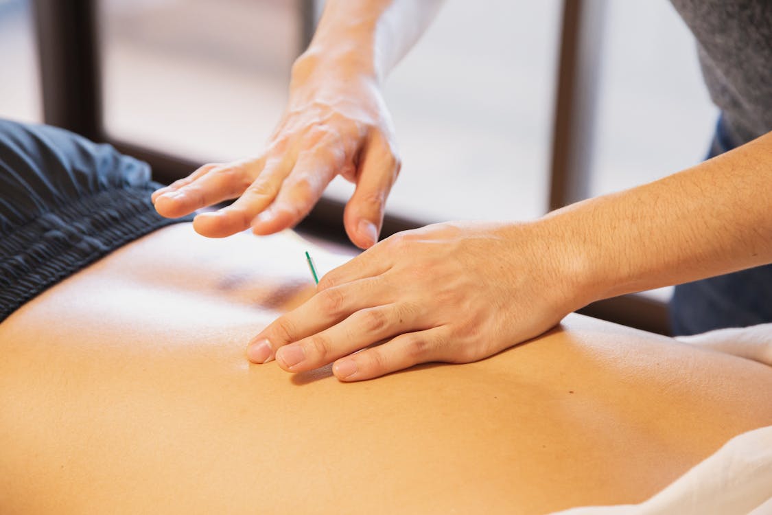 Free Crop anonymous male doctor putting needles on back during acupuncture therapy session in rehabilitation salon Stock Photo
