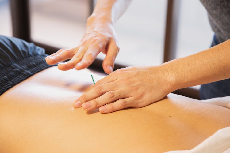 Therapist Pricking Skin With Needles During Treatment Procedure