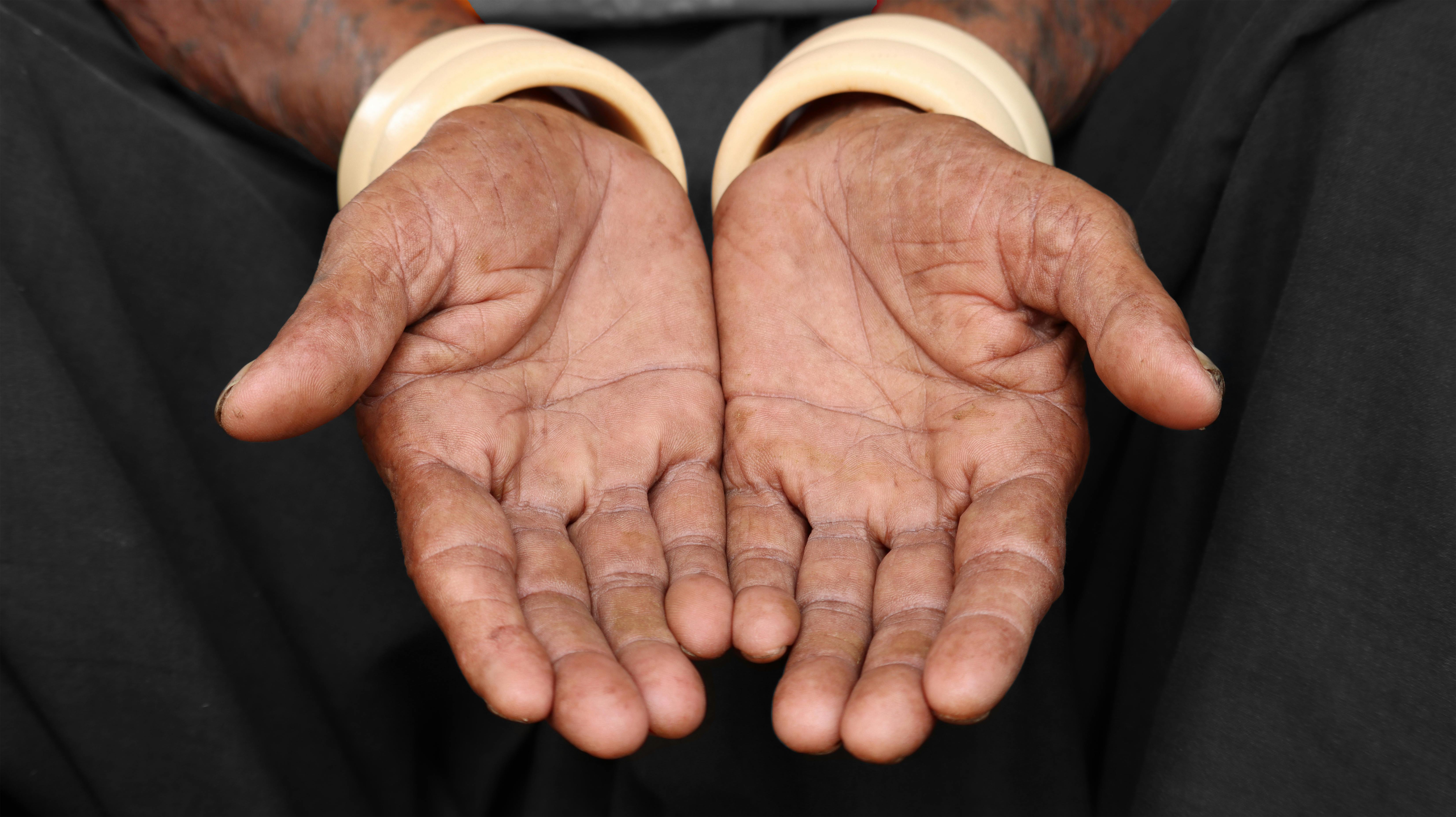 Free Detailed close-up of open hands of an elderly person, emphasizing texture and bangle adornments. Stock Photo