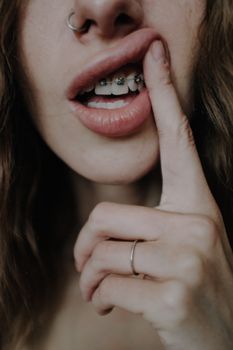 Crop woman with teeth retainers lifting upper lip with finger