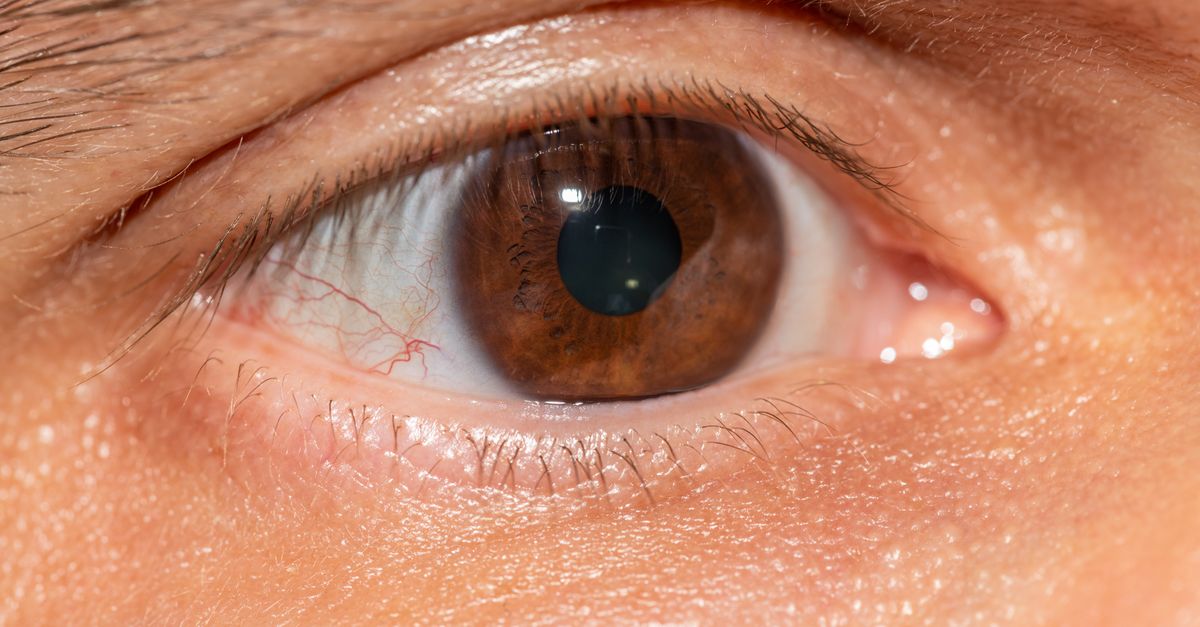 AIIMS Expands Cornea Retrieval Network with Three New Hospitals