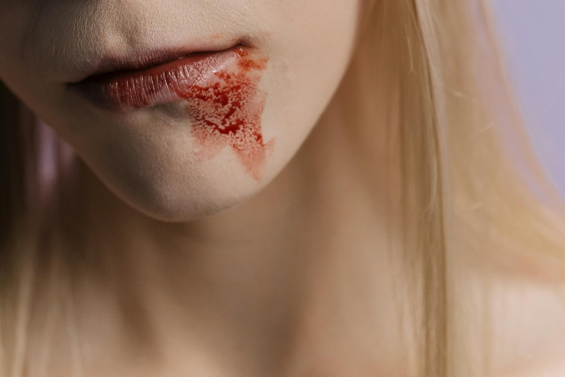 A Person with Blood Stain on Her Chin