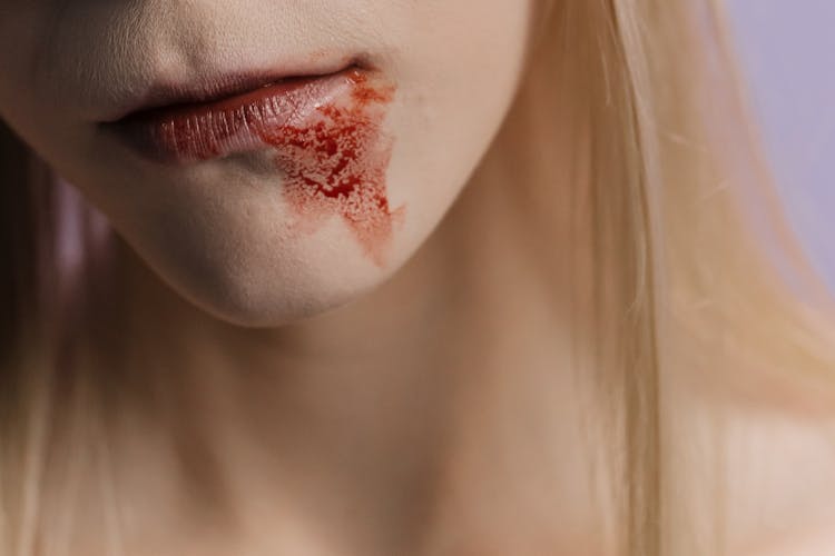 A Person With Blood Stain On Her Chin