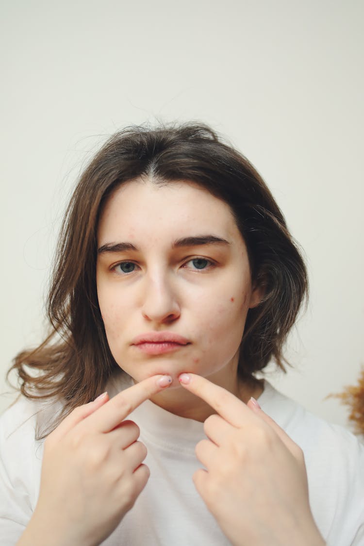 A Woman Popping Her Pimple 