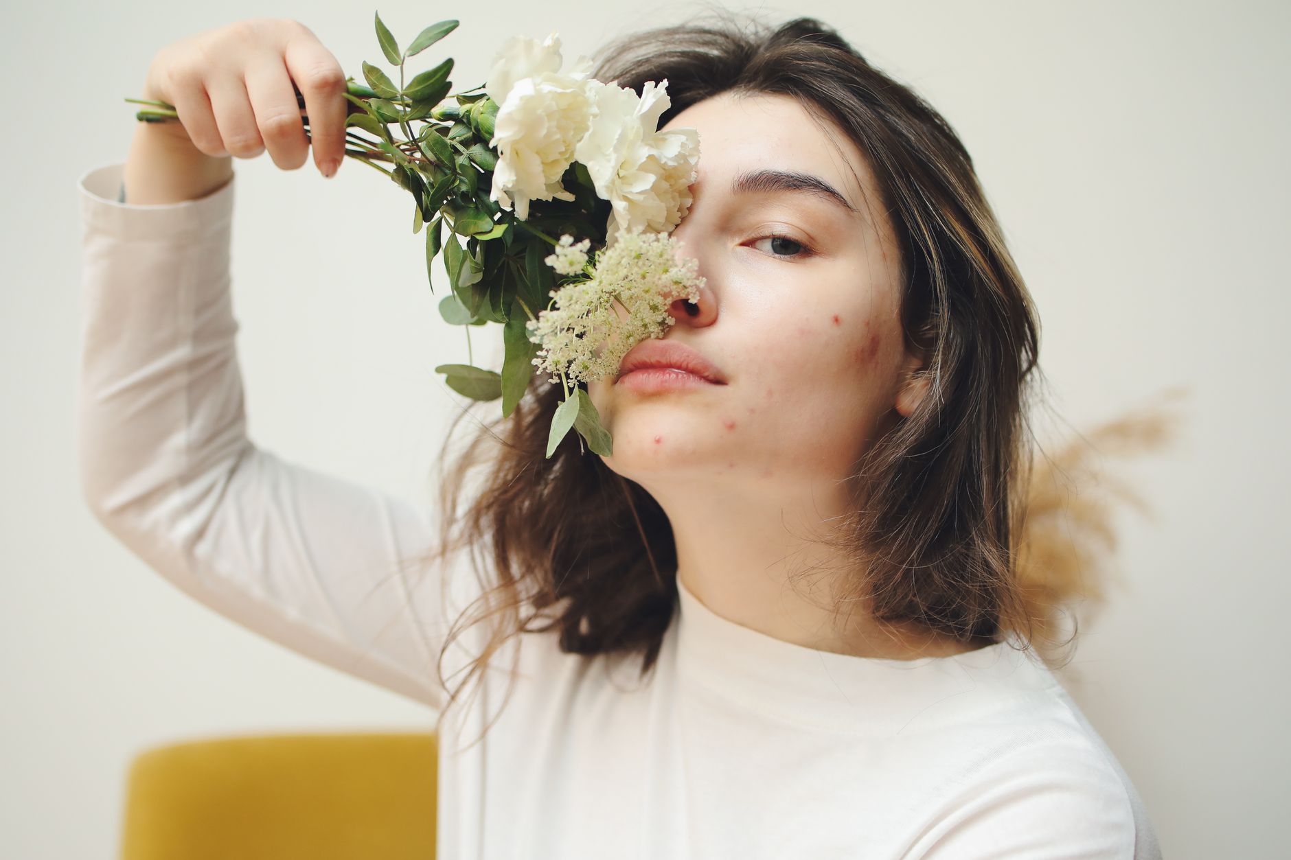 Understanding and Managing Postpartum Acne: A Guide for New Mothers