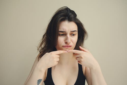 Free A Woman Touching her Pimple Stock Photo