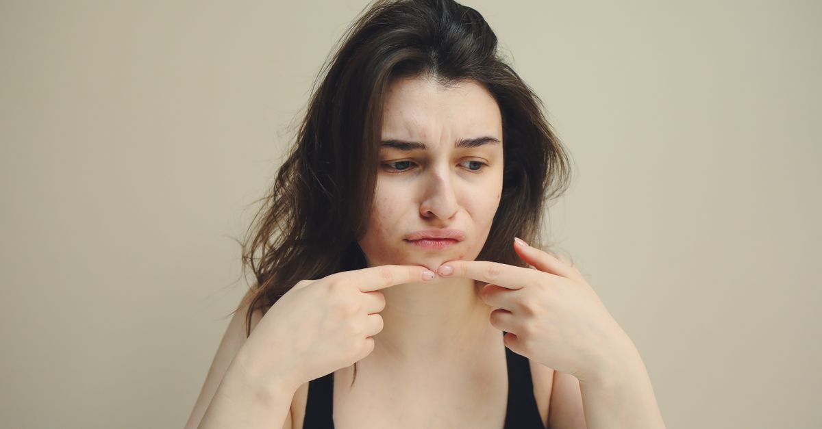 Why Do Hormonal Imbalances Trigger Acne