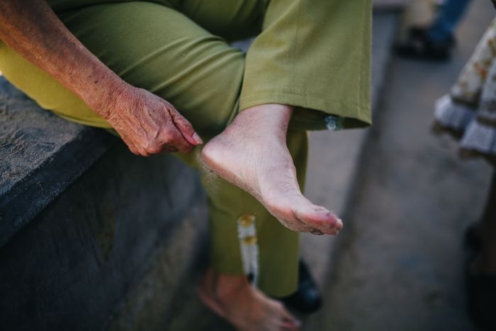 Tired, aching feet and ankles