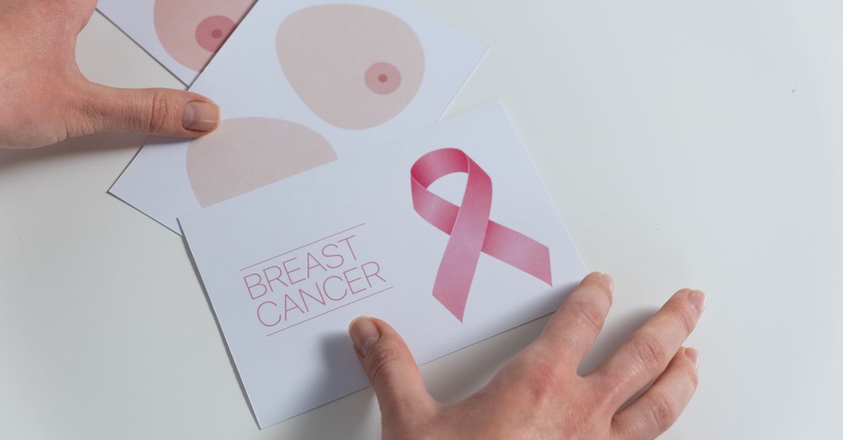 AI in Mammography: Transforming Early Breast Cancer Detection