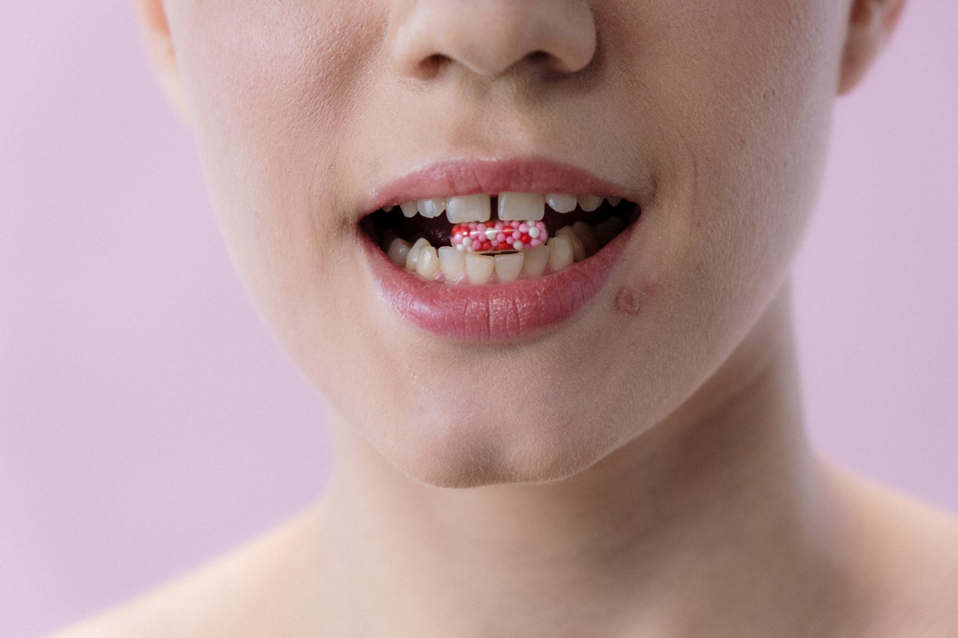 Understanding Your Mouth's Frenum: What It Is and When to Seek Help