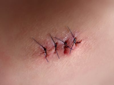 ICI cycle planning chart with success statistics