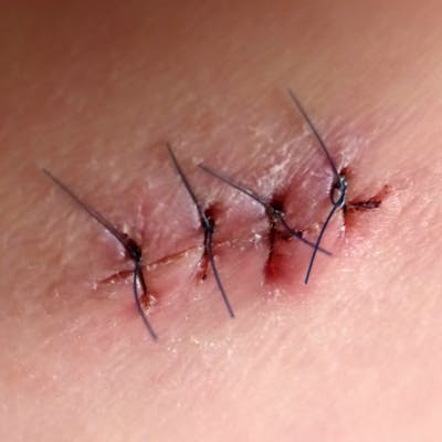 DHEA supplement with scientific research on fertility