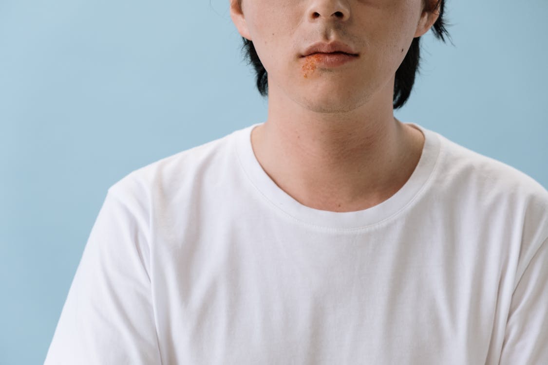 A man in a white shirt with bumps around his mouth. 