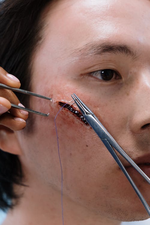 Free Close-up of a Man Getting Stitches on his Cheek Stock Photo