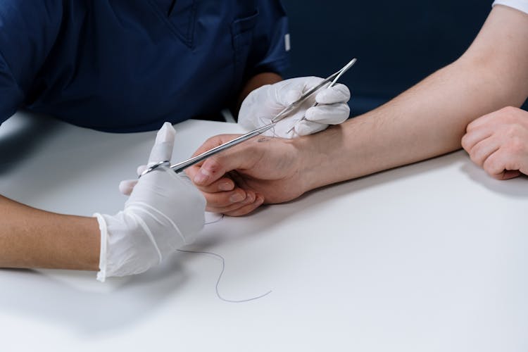 A Person Getting Stitches On Their Hand