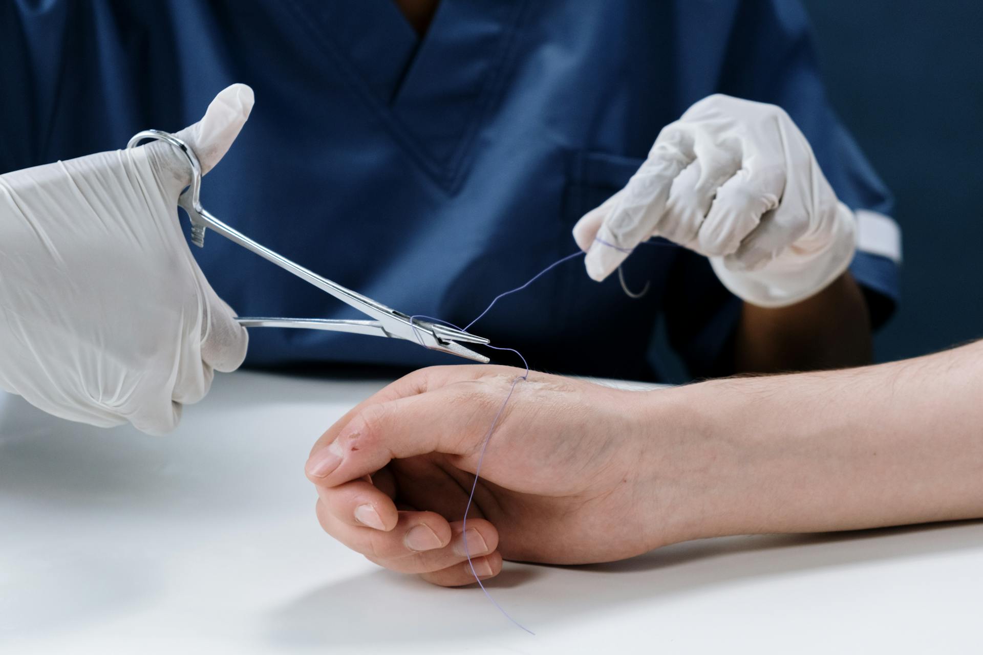 A Person Getting Stitches on their Hand