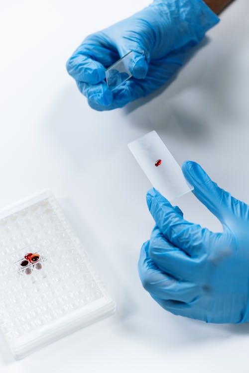 A Person Holding a Microscope Slide with a Blood Sample