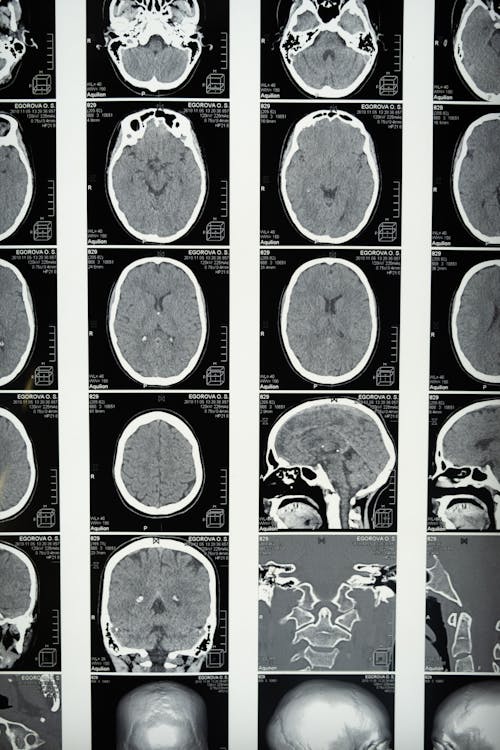 Free Medical Imaging of the Brain Stock Photo