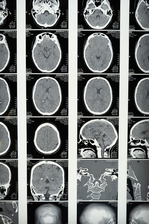 Δωρεάν στοκ φωτογραφιών με mri, ανατομία, απεικόνιση μαγνητικού συντονισμού Φωτογραφία από στοκ φωτογραφιών