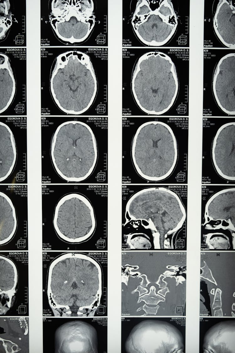 Medical Imaging Of The Brain